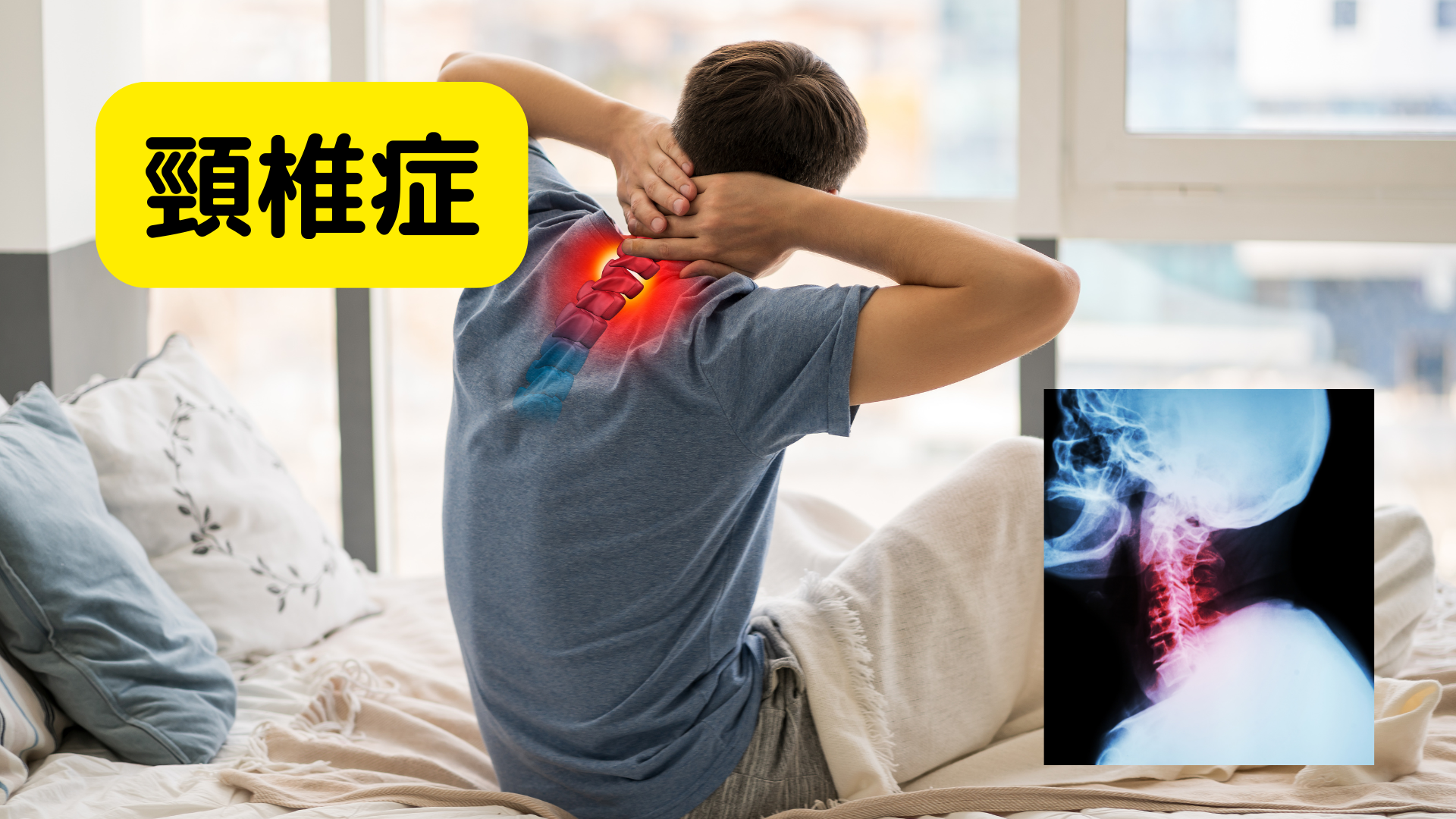 頸椎症について
